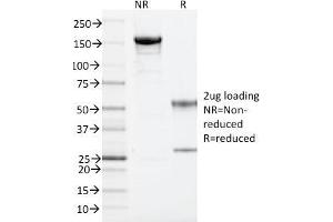 SDS-PAGE Analysis Purified ARF1 Mouse Monoclonal Antibody (ARF1/2117).