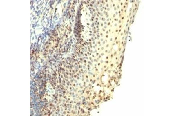 Nuclear Antigen antibody