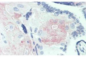 Detection of FGL2 in Human Placenta Tissue using Polyclonal Antibody to Fibrinogen Like Protein 2 (FGL2) (FGL2 antibody  (AA 20-432))