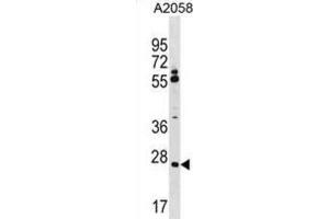 Western Blotting (WB) image for anti-Canopy 3 Homolog (CNPY3) antibody (ABIN5019952) (TNRC5 antibody)