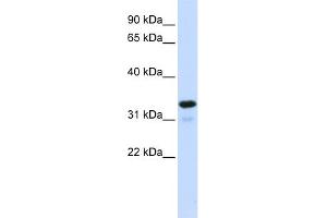 Western Blotting (WB) image for anti-Nuclear Factor of kappa Light Polypeptide Gene Enhancer in B-Cells Inhibitor, alpha (NFKBIA) (Middle Region) antibody (ABIN2792229)