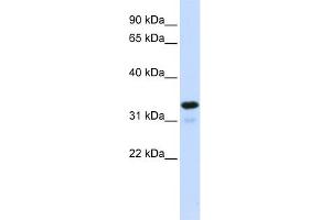 WB Suggested Anti-NFKBIA Antibody Titration:  0.