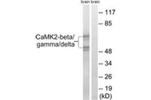 Western blot analysis of extracts from rat brain cells, using CaMK2-beta/gamma/delta (Ab-287) Antibody. (CaMK2 beta/gamma/delta (AA 253-302) antibody)