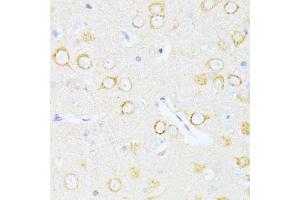 Immunohistochemistry of paraffin-embedded rat brain using Casp8 antibody. (Caspase 8 antibody)