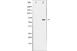 Western blot analysis of Shc phosphorylation expression in EGF treated 293 whole cell lysates,The lane on the left is treated with the antigen-specific peptide. (SHC1 antibody  (pTyr427))