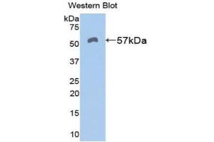Western blot analysis of the recombinant protein. (ALDH7A1 antibody  (AA 29-539))