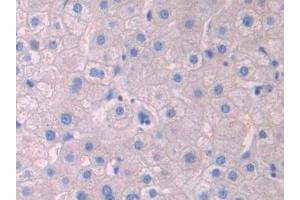 Detection of LCAT in Human Liver Tissue using Polyclonal Antibody to Lecithin Cholesterol Acyltransferase (LCAT) (LCAT antibody  (AA 290-433))