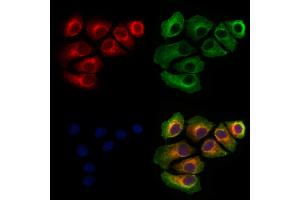 ABIN6265572 and ABIN6273080 staining Hela cells by IF/ICC.