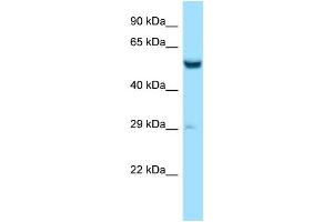 Western Blotting (WB) image for anti-Zinc Finger CCCH-Type Containing 10 (ZC3H10) (N-Term) antibody (ABIN2788533)