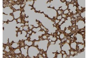 ABIN6276650 at 1/100 staining Mouse lung tissue by IHC-P. (TYR antibody  (C-Term))