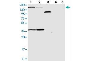 Western blot analysis of Lane 1: RT-4, Lane 2: U-251 MG, Lane 3: Human Plasma, Lane 4: Liver, Lane 5: Tonsil with SAMD9 polyclonal antibody  at 1:250-1:500 dilution. (SAMD9 antibody)
