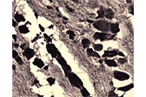 IHC on rat DRG (free floating cryo section) using rabbit SORT1 polyclonal antibody  at a dilution of 1 : 1000.