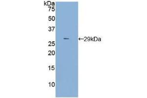 Western blot analysis of recombinant Rat TLR4. (TLR4 antibody  (AA 49-247))