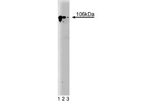 Western blot analysis of SATB1 on a Jurkat cell lysate (Human T-cell leukemia, ATCC TIB-152). (SATB1 antibody  (AA 550-667))
