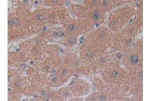 Detection of NT5C3 in Human Liver Tissue using Polyclonal Antibody to 5'-Nucleotidase, Cytosolic III (NT5C3) (NT5C3 antibody  (AA 52-336))