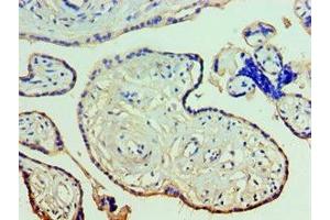 Immunohistochemistry of paraffin-embedded human placenta tissue using ABIN7144263 at dilution of 1:100 (Annexin A11 antibody  (AA 276-505))