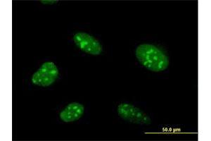 Immunofluorescence of purified MaxPab antibody to ZNF593 on HeLa cell. (ZNF593 antibody  (AA 1-116))