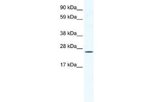 Western Blotting (WB) image for anti-BRF1, RNA polymerase III transcription initiation factor subunit (BRF1) (C-Term) antibody (ABIN925854)