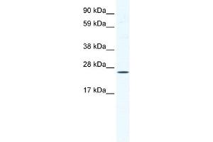 BRF1 antibody (20R-1153) used at 2. (BRF1 antibody  (C-Term))