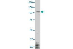 EHMT1 monoclonal antibody (M04), clone 1H2 Western Blot analysis of EHMT1 expression in MES-SA/Dx5 . (EHMT1 antibody  (AA 1-100))