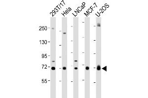 All lanes : Anti-GC Antibody (Center) at 1:2000 dilution Lane 1: 293T/17 whole cell lysate Lane 2: Hela whole cell lysate Lane 3: LNCaP whole cell lysate Lane 4: MCF-7 whole cell lysate Lane 5: U-2OS whole cell lysate Lysates/proteins at 20 μg per lane. (Gc (AA 337-365), (Center) antibody)