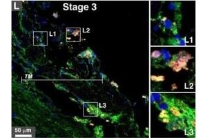 Fetuin A antibody  (AA 200-240) (Alexa Fluor 594)