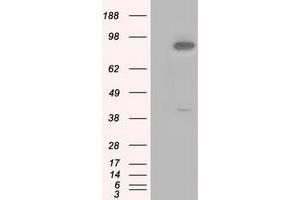 Image no. 4 for anti-Betaine--Homocysteine S-Methyltransferase (BHMT) antibody (ABIN1496917)