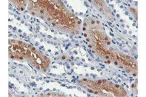 Immunohistochemical staining of paraffin-embedded Human Kidney tissue using anti-SHPK mouse monoclonal antibody. (SHPK antibody)