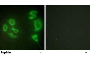 Immunofluorescence analysis of HepG2 cells, using ZAK polyclonal antibody . (ZAK antibody  (C-Term))