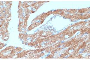 Immunohistochemistry of paraffin-embedded Mouse heart using ACSL3 Polyclonal Antibody at dilution of 1:100 (40x lens). (Acsl3 antibody)