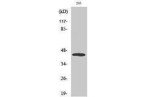 Western Blotting (WB) image for anti-Mitogen-Activated Protein Kinase Kinase 4 (MAP2K4) (pThr261) antibody (ABIN3172930) (MAP2K4 antibody  (pThr261))