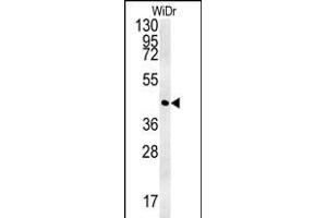 CCYL1 Antibody (N-term) (ABIN651917 and ABIN2840452) western blot analysis in WiDr cell line lysates (35 μg/lane). (CCNYL1 antibody  (N-Term))