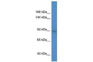 BCL11A antibody used at 0. (BCL11A antibody  (C-Term))
