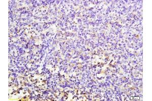 Formalin-fixed and paraffin embedded mouse lymphoma labeled with Anti-MuRF1/Trim63 Polyclonal Antibody, Unconjugated  at 1:200 followed by conjugation to the secondary antibody and DAB staining. (CD7 antibody  (AA 181-240))