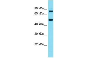 Western Blotting (WB) image for anti-Kelch Repeat and BTB (POZ) Domain Containing 6 (KBTBD6) (N-Term) antibody (ABIN2791601) (KBTBD6 antibody  (N-Term))