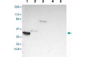 Western blot analysis of Lane 1: RT-4, Lane 2: U-251 MG, Lane 3: Human Plasma, Lane 4: Liver, Lane 5: Tonsil with TFAP4 polyclonal antibody .