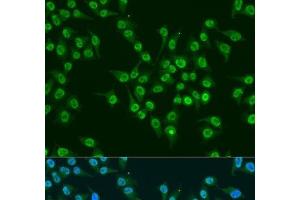 Immunofluorescence analysis of U2OS cells using KLF4 Polyclonal Antibody at dilution of 1:100. (KLF4 antibody)