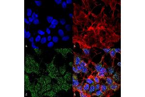 Immunocytochemistry/Immunofluorescence analysis using Mouse Anti-VGLUT2 Monoclonal Antibody, Clone S29-29 (ABIN1027711). (Solute Carrier Family 17 (Vesicular Glutamate Transporter), Member 6 (SLC17A6) (AA 501-582) antibody)