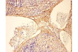 Immunohistochemistry (IHC) image for anti-Complement Component 5a (C5a) (N-Term) antibody (ABIN3029692)