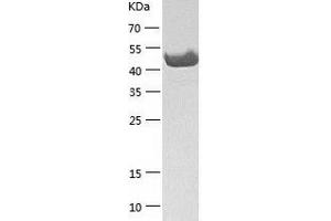 Western Blotting (WB) image for Zinc Finger Protein 70 (ZNF70) (AA 1-446) protein (His tag) (ABIN7289243) (ZNF70 Protein (AA 1-446) (His tag))