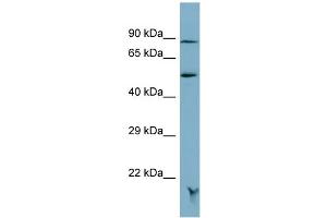 Host:  Rabbit  Target Name:  MRAP  Sample Type:  OVCAR-3 Whole cell lysates  Antibody Dilution:  1. (MRAP antibody  (N-Term))