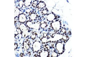 Immunohistochemistry of paraffin-embedded rat brown adipose using PPARγ Rabbit pAb (ABIN6134090, ABIN6146004, ABIN6146006 and ABIN6215096) at dilution of 1:250 (40x lens). (PPARG antibody  (AA 70-170))