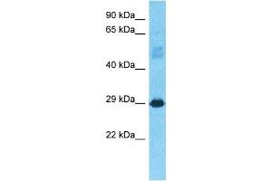 Host:  Rabbit  Target Name:  CJ076  Sample Type:  Fetal Liver lysates  Antibody Dilution:  1.