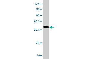 Western Blot detection against Immunogen (35. (CDK4 antibody  (AA 211-303))