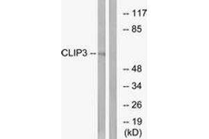 Western Blotting (WB) image for anti-CAP-GLY Domain Containing Linker Protein 3 (CLIP3) (AA 361-410) antibody (ABIN2890180) (CLIP3 antibody  (AA 361-410))