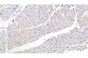 Detection of NPPB in Human Cardiac Muscle Tissue using Polyclonal Antibody to Natriuretic Peptide Precursor B (NPPB)