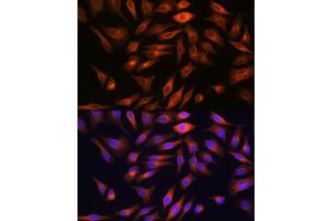 Immunofluorescence analysis of HeLa cells using FBP1 Rabbit mAb (ABIN7267269) at dilution of 1:100 (40x lens). (FBP1 antibody)