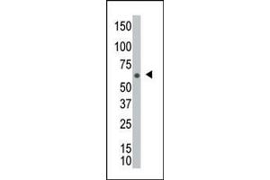 The anti-NEK8 Pab (ABIN391137 and ABIN2841258) is used in Western blot to detect NEK8 in  cell lysate. (NEK8 antibody  (C-Term))