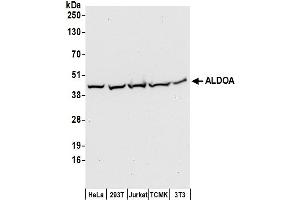 Western Blotting (WB) image for anti-Aldolase A, Fructose-Bisphosphate (ALDOA) (AA 50-100) antibody (ABIN7453026)