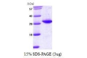 Figure annotation denotes ug of protein loaded and % gel used. (TPMT Protein (AA 1-245))